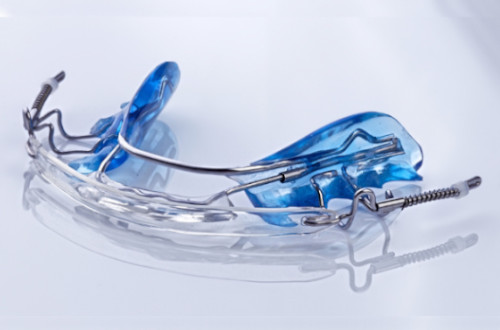 photot showing the wires and plastic of a removable aligner on a white background 